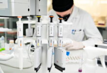 ميركل: السلالة البريطانية من كورونا أكثر خطورة على الشباب 112112