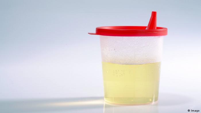 Urine sample (Picture: Imago)