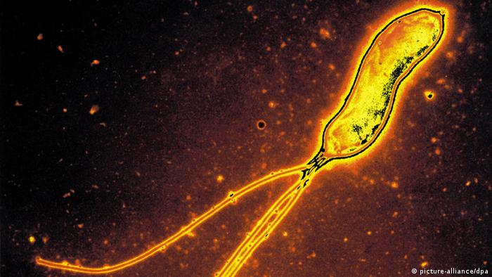 Studie: Magenbakterium könnte vor Asthma schützen